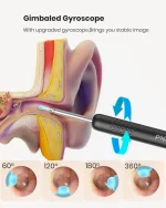 Bebird R1 Smart Ear Wax Removal Tool with HD Camera and Wireless App Control