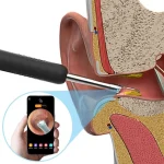 Bebird R1 Smart Ear Wax Removal Tool with HD Camera and Wireless App Control