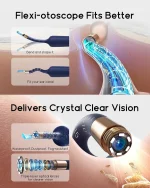 Bebird EarSight Plus smart visual ear cleaner camera with detachable tweezers and 10MP HD lens for safe earwax removal