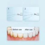 Xiaomi Mijia F300 Portable Oral Irrigator Dental Water Flosser with 240ML Tank and 115-Day Battery