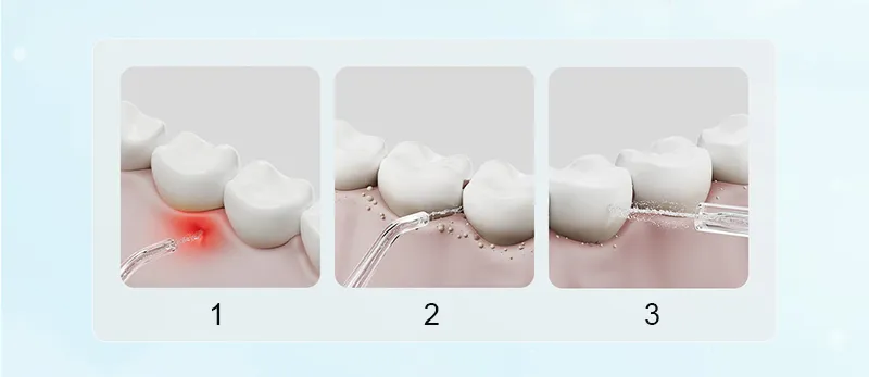 Xiaomi Mijia F300 Portable Oral Irrigator Dental Water Flosser with 240ML Tank and 115-Day Battery