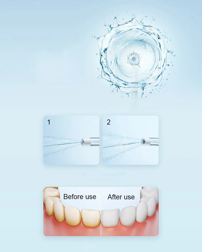 Xiaomi Mijia F300 Portable Oral Irrigator Dental Water Flosser with 240ML Tank and 115-Day Battery