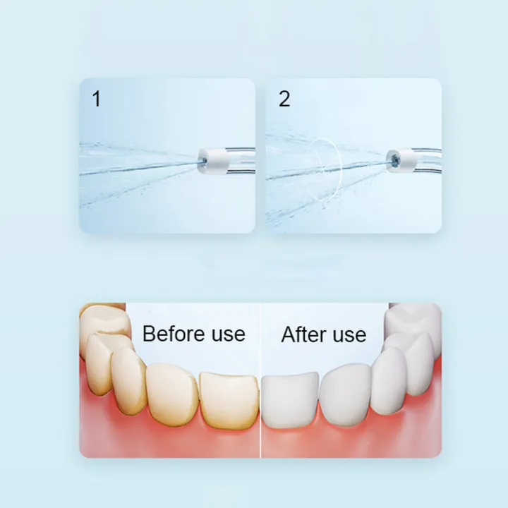 Xiaomi Mijia F300 Portable Oral Irrigator Dental Water Flosser with 240ML Tank and 115-Day Battery