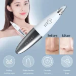 Xiaomi inFace MS7000 Blackhead Remover